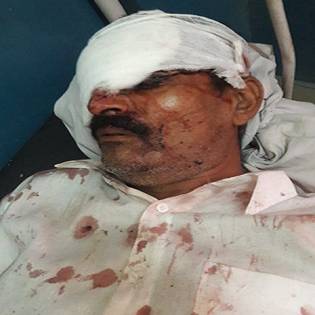 Two killed in a car rammed into a truck parked late at night 3 injured in Banda