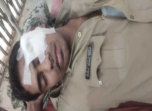 Big news of UP: 4 police personnel including ASP injured in stone pelting of angry mob