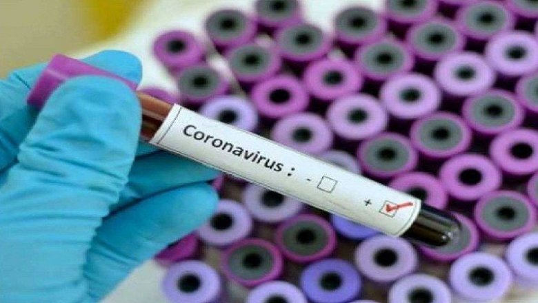 Covid 19 : बांदा में दो कोरोना संक्रमितों की मौत, 306 सक्रिय मरीज
