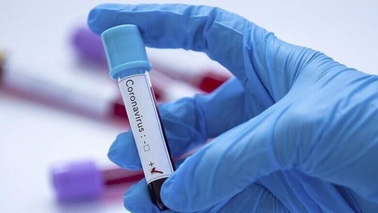 Amroha News : 24 घंटे में बढ़ी कोरोना संक्रमितों की संख्या 25 और पाॅजिटिव..
