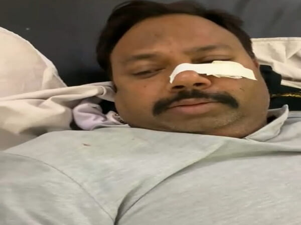 Knife among sons of gutkha trader in Banda, one injured, there is dispute over property distribution